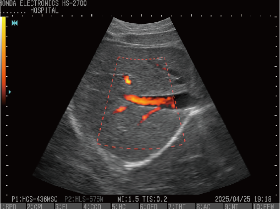 HS-2700 (new)202579_8