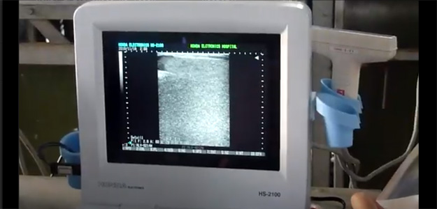 HS-2200V+HLV-4212Mで牛の肉質判定をしている動画のサムネイル画像 loading=